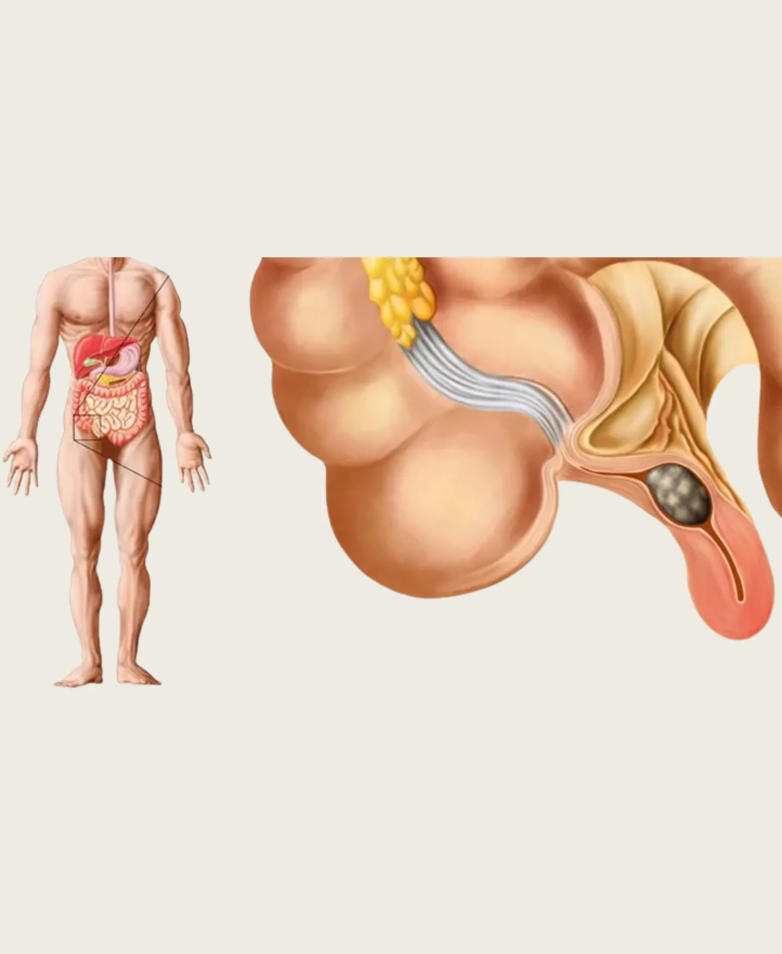 Dr. Neel Patel - Appendix care at Niraaya Hospital Gandhinagar